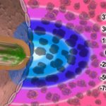 Cryoablation_01