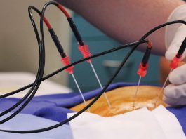 Χρόνιος πόνος στην μέση