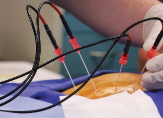 Χρόνιος πόνος στην μέση