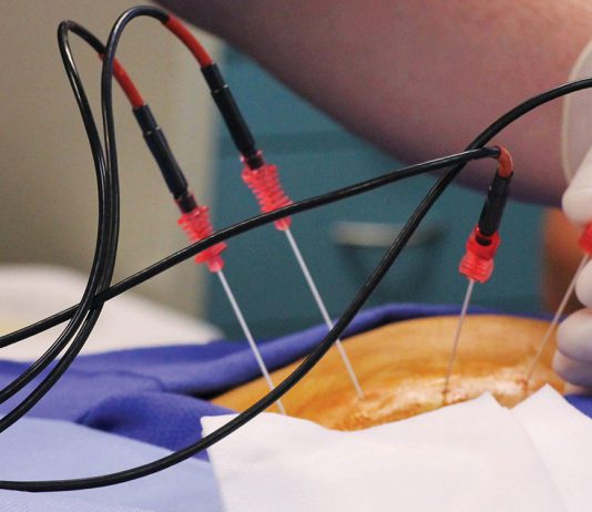 Χρόνιος πόνος στην μέση