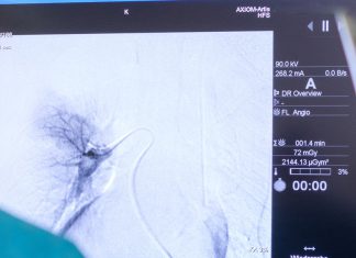 Χημειοεμβολισμός ήπατος – TACE