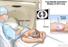 Βιοψία οργάνων