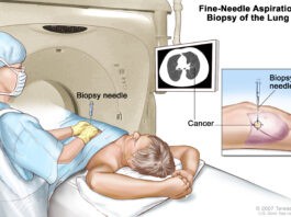 Βιοψία οργάνων