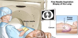 Βιοψία οργάνων