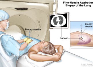 Βιοψία οργάνων