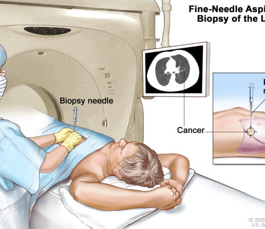 Βιοψία οργάνων