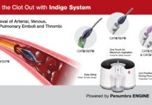 Θρομβοαναρρόφηση σε Πνευμονική Εμβολή (ΠΕ)