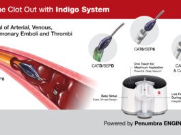 Θρομβοαναρρόφηση σε Πνευμονική Εμβολή (ΠΕ)