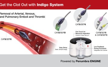 Θρομβοαναρρόφηση σε Πνευμονική Εμβολή (ΠΕ)