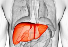 Εμβολισμός πυλαίας φλέβας (PVE)