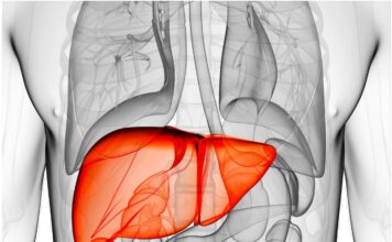 Εμβολισμός πυλαίας φλέβας (PVE)