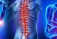 Οστεοπόρωση