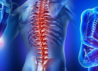 Οστεοπόρωση