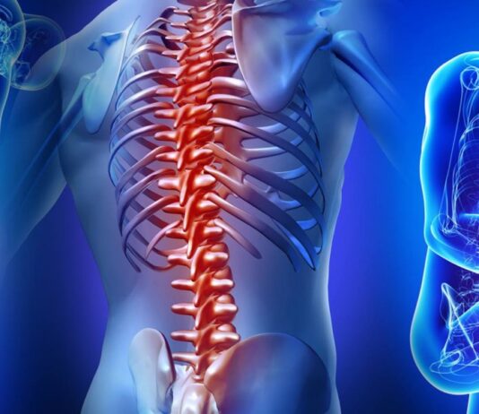 Οστεοπόρωση