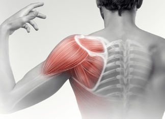 Άλγος ώμου (ωμαλγία)