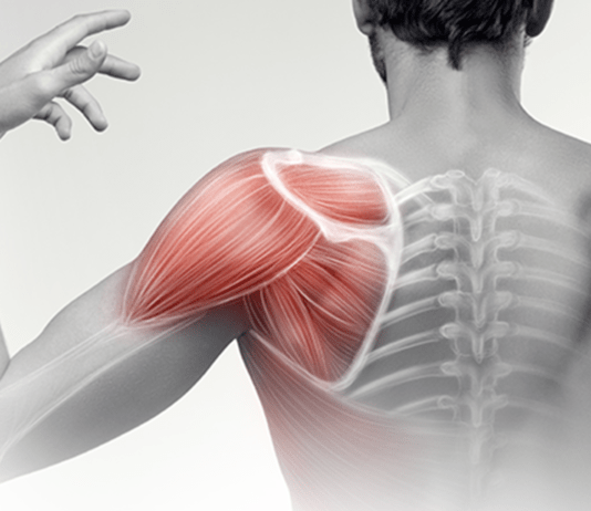 Άλγος ώμου (ωμαλγία)