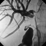 xolifora1 (2)_01
